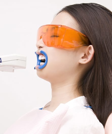 セルフホワイトニングとは１